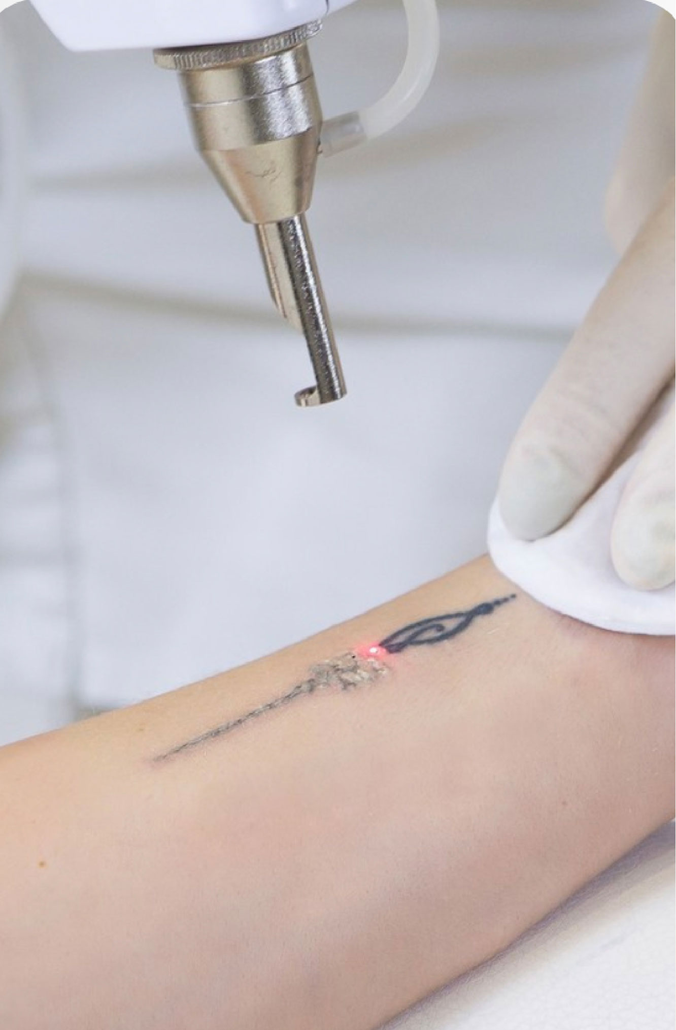Tatuajes