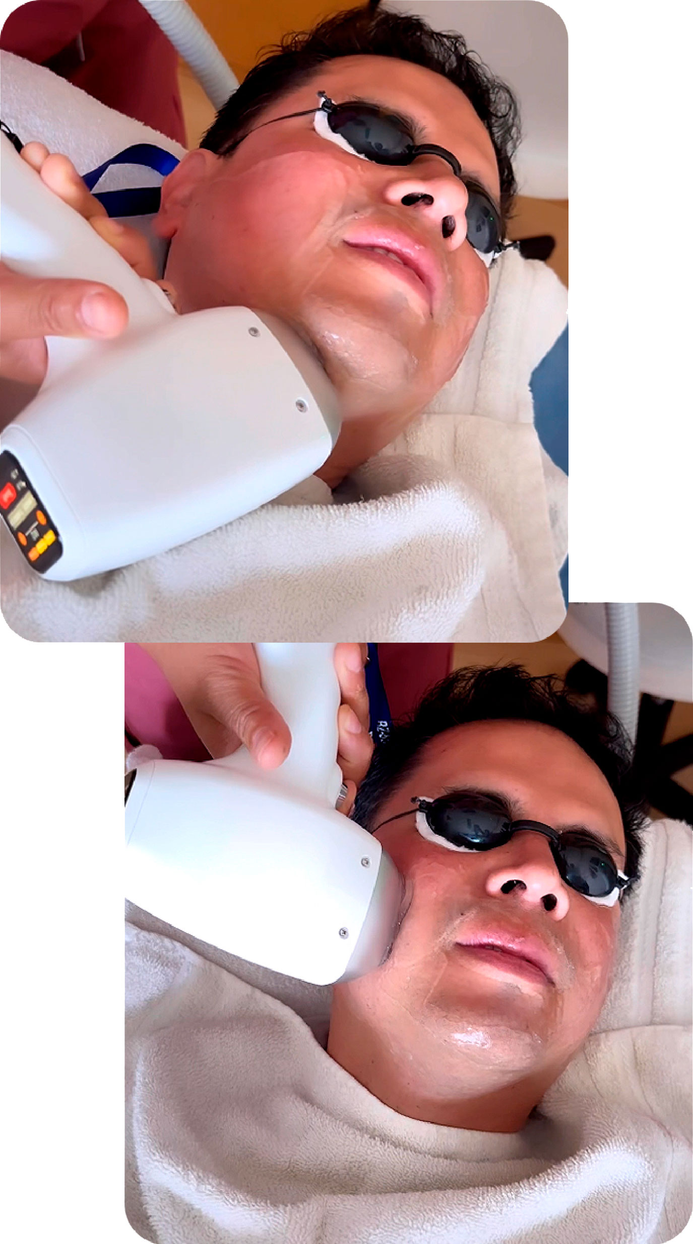 DEPILACION MASCULINO