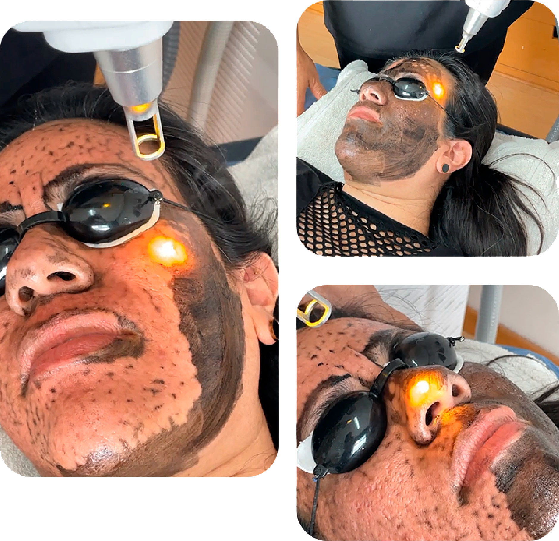 Faciales
