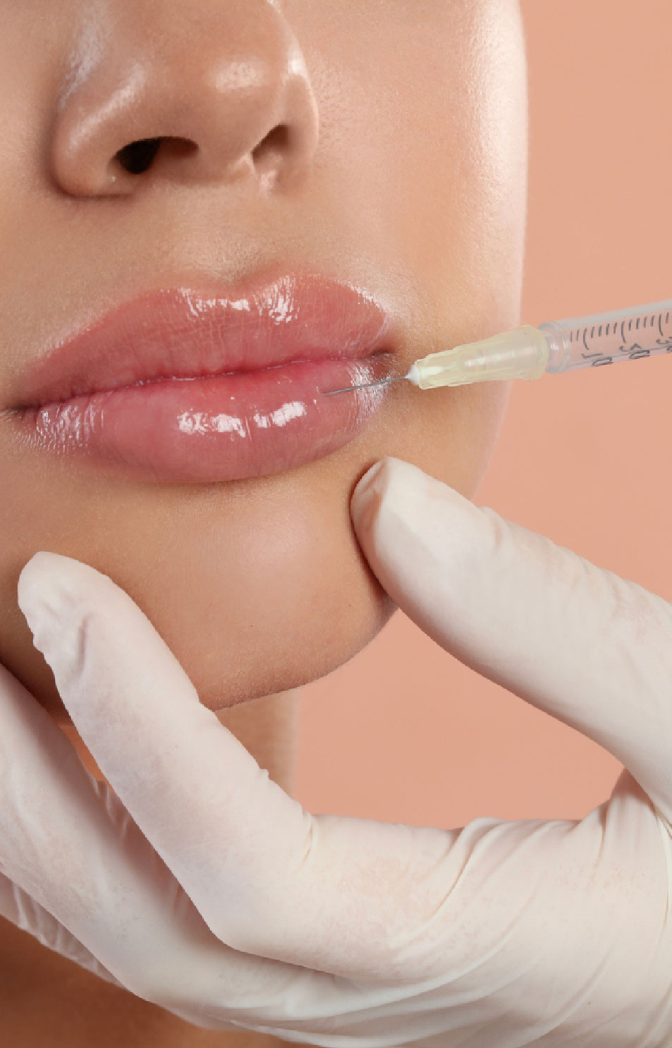 Aumento de labios